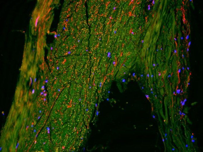 Previously Unrecognized Brain Lymphatic Drainage Pathway Found