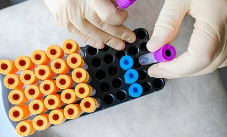 Revolutionary blood test identifies missed endometriosis