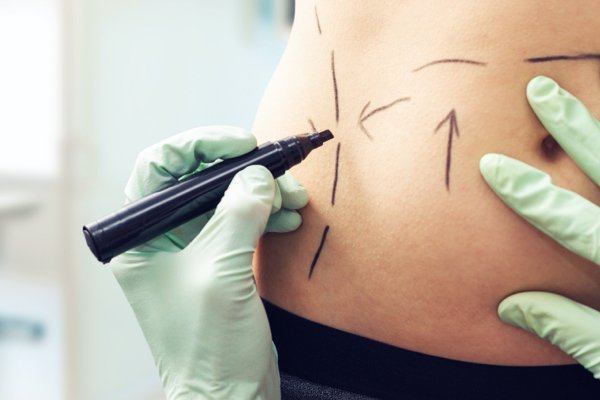 top plastic surgeons san antonio: comprehensive guide 2026