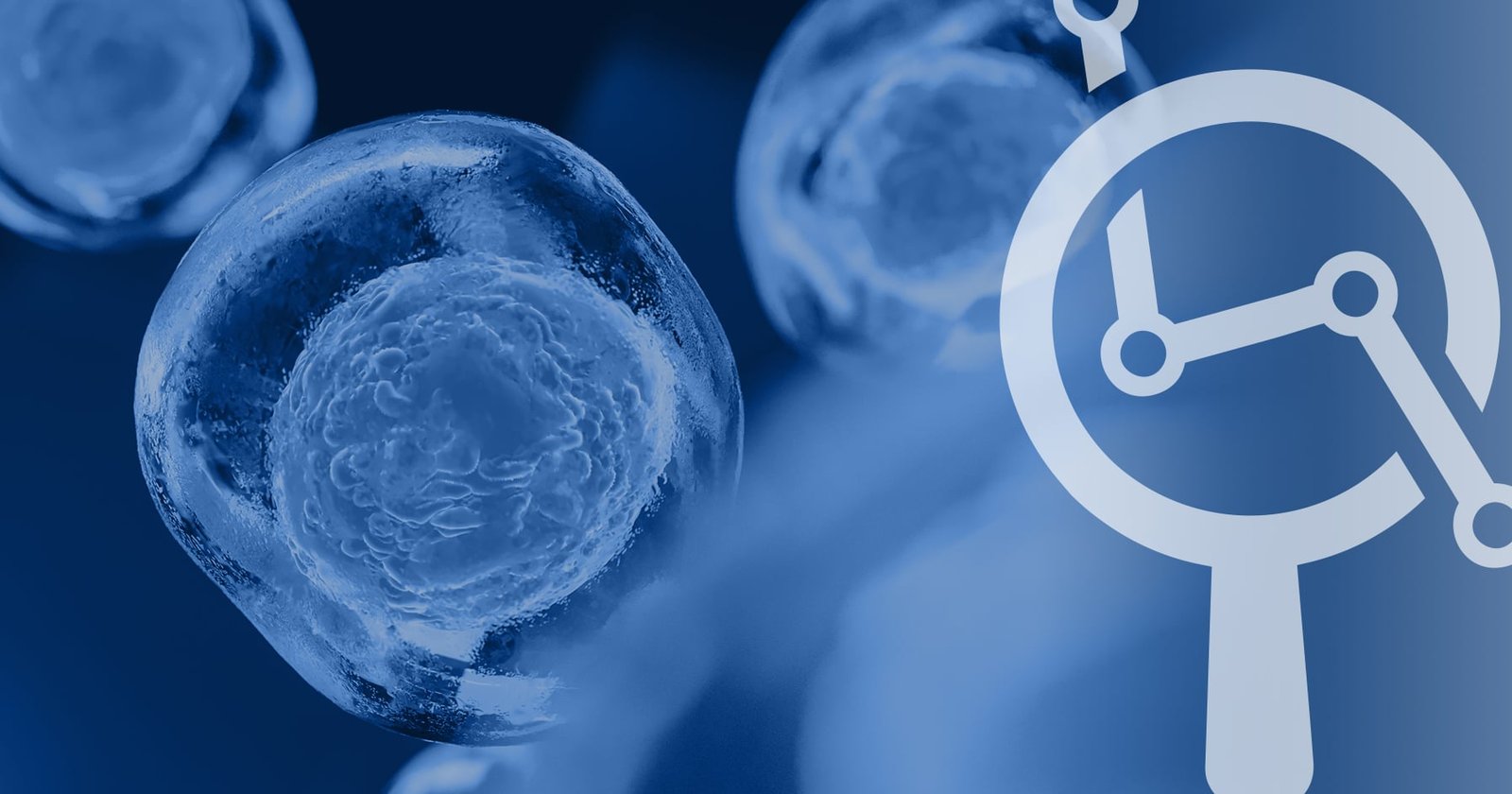 Understanding polyendocrine metabolic ovarian syndrome
