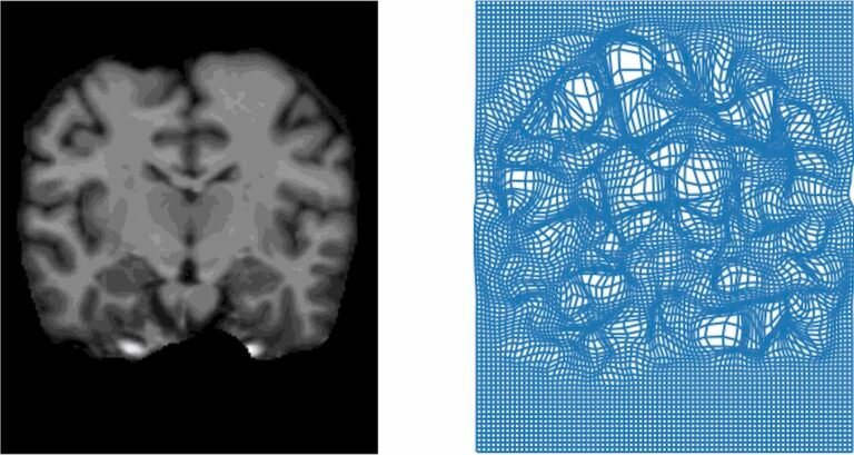 Open source medical image algorithm revolutionizes analysis